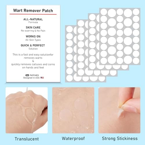 Wabriny skin care removal patches being applied to a hand for discreet wart treatment.