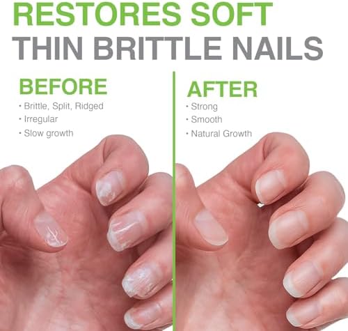 Probelle professional nail care product for achieving strong and healthy natural nails