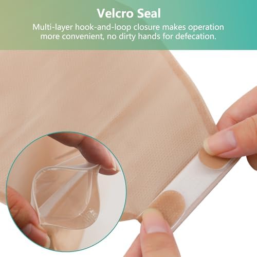 Vlookup 20 count ostomy supply set laid out with stoma size measuring guide card