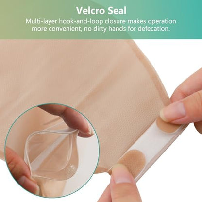 Vlookup 20 count ostomy supply set laid out with stoma size measuring guide card