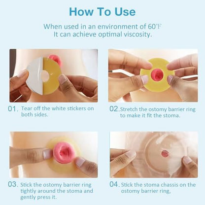 Demonstration of the moldable and stretchable properties of the TNTNDAY ostomy ring.
