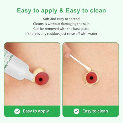ZnnaYoha no sting skin barrier paste for leak prevention around irregular stomas