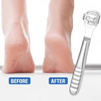 MIUKAA manual corn remover tool for hands and feet in silver finish.