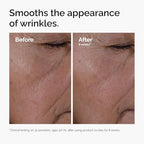 Peptide serum with hyaluronic acid for fine lines and wrinkle care