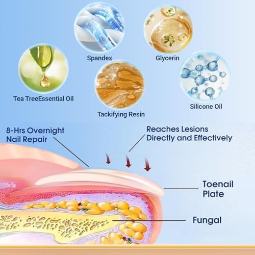 Funga Patch Toenail Treatment applied securely on a foot nail for nighttime repair