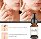 Befada skin tag and mole removal liquid for face and body use.