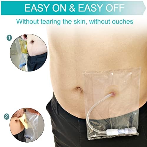 Step by step application of waterproof dialysis catheter shield on clean dry skin
