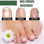 Top view of nail fungus treatment dropper bottle