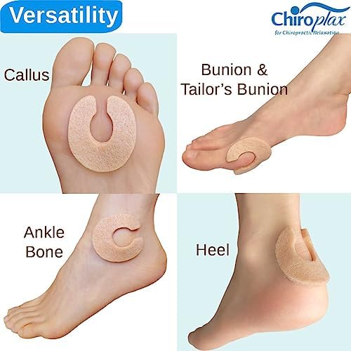 Self-adhesive medical grade felt horseshoe pads for metatarsal support