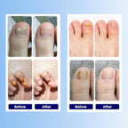 Close-up of beige adhesive hydrogel nail patches in packaging