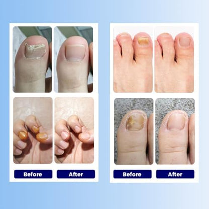 Funga Patch 8-hour firm adhesion technology demonstration on a fingernail
