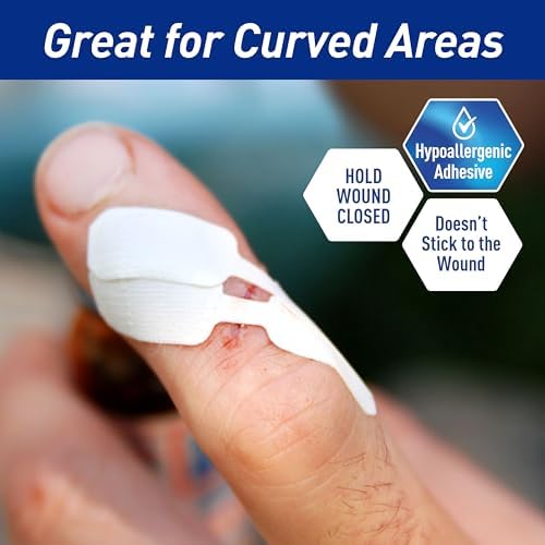 Hospital grade emergency skin closure strips application view.