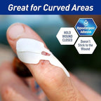 Hospital grade emergency skin closure strips application view.