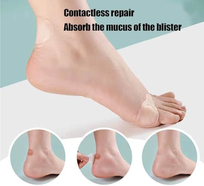 Amasodaon foot bandages being applied to the heel for anti-friction support.