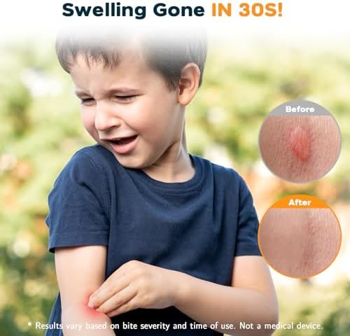 YARKOR insect bite sucker packaging showcasing chemical free relief features