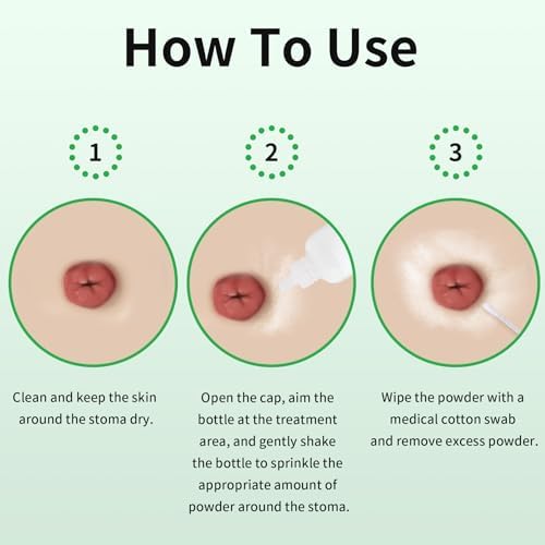 Fine texture of ZnnaYoha non irritating stoma adhesive powder being applied