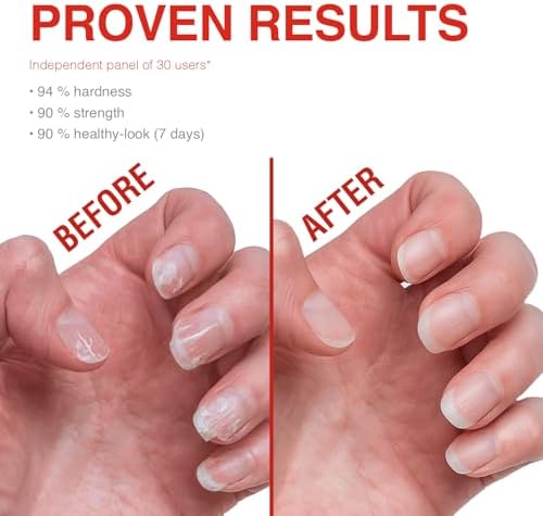 Top view of Probelle 0.5 fluid ounce nail treatment bottle