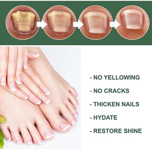 Instructions for using extra strength nail fungus liquid
