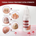 Dermfree Toenail Treatment showing dropper and liquid bottle