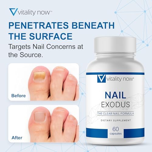 Authentic USA imported Nail Exodus capsules for internal nail cleanse.