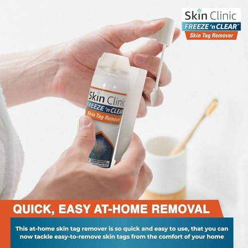 Step by step application of the Skin Clinic freezing tip on a skin tag.