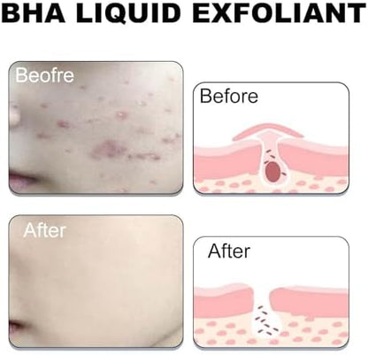 Paula's Choice BHA exfoliant application with cotton pad