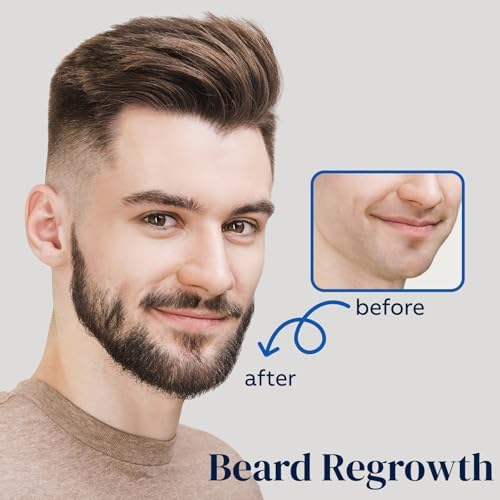Two bottles of paraben free minoxidil and biotin formula for unisex thinning hair support