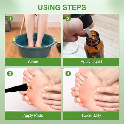 Close up of MQFORU liquid applicator for common and plantar callus removal.