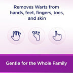 WartStick waxy solid formula being applied to a common wart on the hand.