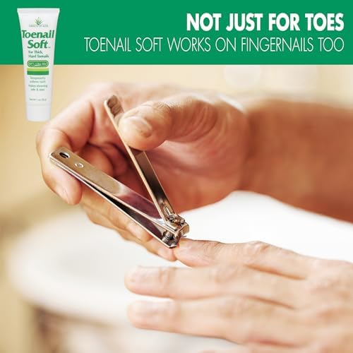 Miracle of Aloe toenail cream tube displayed against clean background