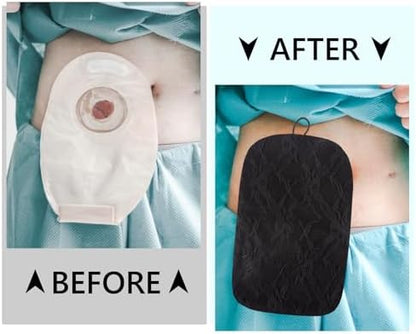 Detailed texture of the premium polyester and lace used in ZHUOGWJFJ ostomy accessories.