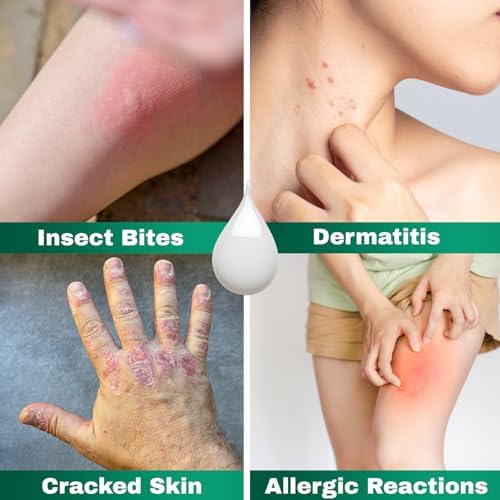 Barmicil Plus 1 ounce tube for travel-friendly first aid and bug bite relief.