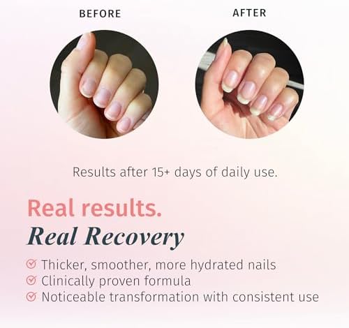 Duri Rejuvacote 1 used as a base coat and top coat for professional nail maintenance