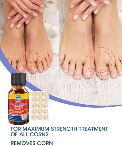 MYMULIKE Corn Remover kit showing liquid bottle cushions and cotton swabs