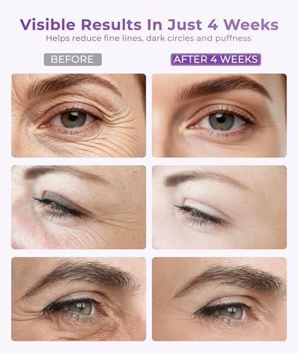 Premium anti aging under eye glasses with built in microcurrent technology plates.