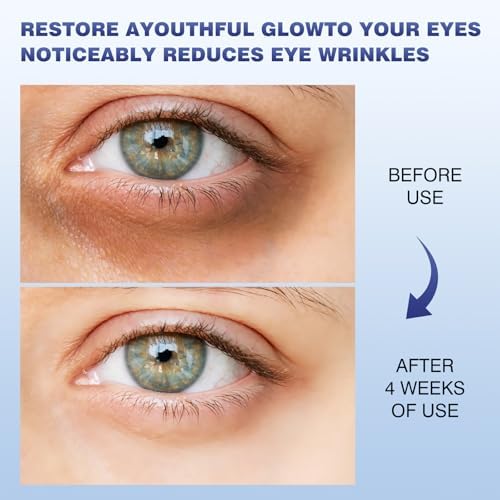 CHHQLZS hydrating eye cream lifestyle shot for daily skincare routine