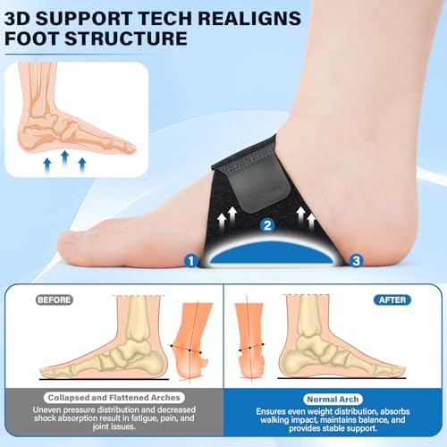 Side view of the ERGOfoot brace being worn on a foot to demonstrate arch lifting capability.