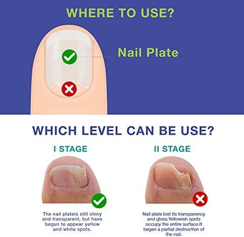 Dr. Luke 1 ounce nail repair liquid packaging for discolored nails.
