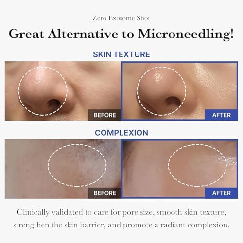 Korean skin booster serum with AHA BHA PHA triple acid complex