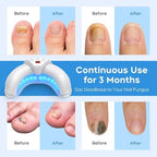 White ZZP home use nail device for multiple fingernails