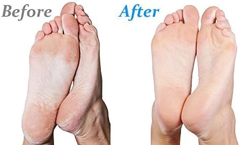 Side profile of Emjoi Micro-Pedi 3D showing ergonomic handle and roller head