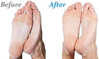 Side profile of Emjoi Micro-Pedi 3D showing ergonomic handle and roller head