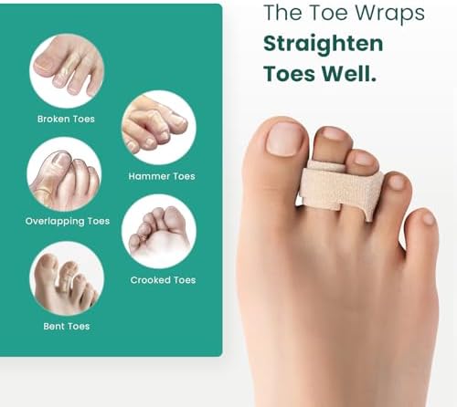 Welnove beige cushioned toe wraps applied to overlapping toes