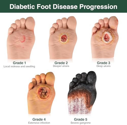 Close up of Ultrassist anatomical human foot model with fixed base plate for stability.
