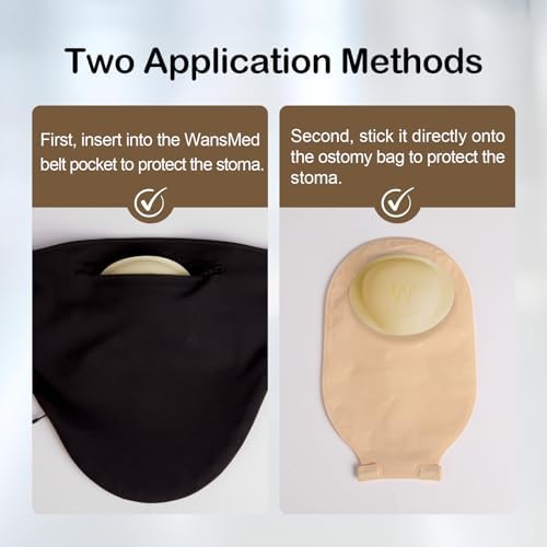 Wansmed Stoma Guard applied to an ostomy bag