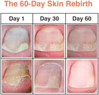 Nourished cuticles after using TuneTune fermented oil