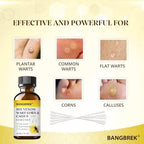 Bee venom boosted formula for plantar wart and corn removal