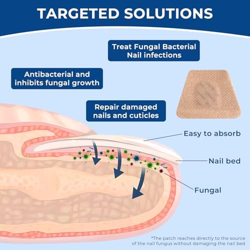 Kitmous extra strength nail patches showing 8-hour nighttime renewal benefit