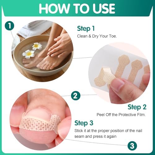 Step by step application guide for the trim to fit professional paronychia correction tool.