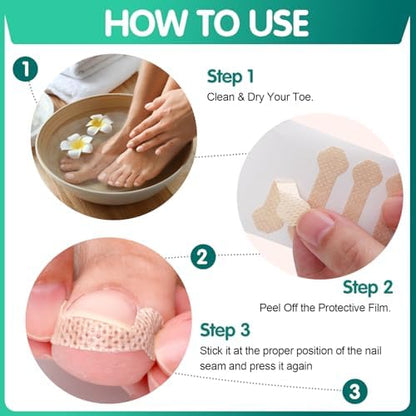 Step by step application guide for the trim to fit professional paronychia correction tool.